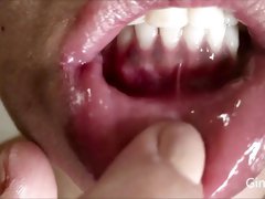 Mouth, teeth and tongue check (Short version)